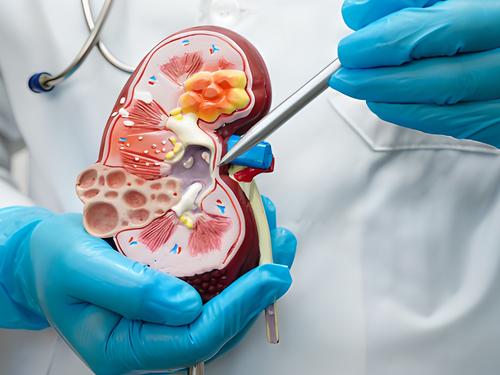 /public/cms/expertise/allgemeinmedizin-nephrologische-basisuntersuchung.jpg