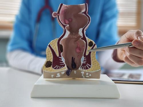 /public/cms/expertise/gastroenterologie-proktologie-proktologie-enddarmerkrankungen.jpg