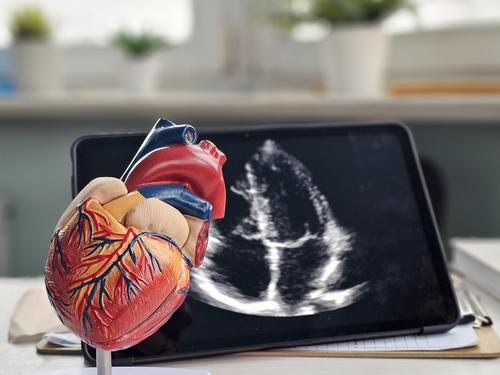 /public/cms/expertise/kardiologie-echokardiographie-und-stressechokardiographie.jpg