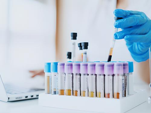 /public/cms/expertise/kardiologie-labordiagnostik-blutuntersuchungen-herzmarker.jpg